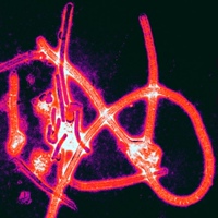 Эбола Вирус, Конго, демократическая республика, Mbuji-Mayi